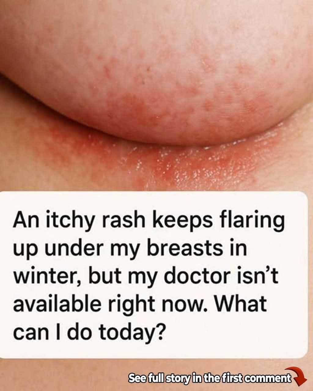 Underb Painful Underb**b Rash? 5 Common Causes You Should Know - Story News